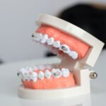 Tips-to-Straighten-Your-Teeth-Faster-With-Ease-on-lightningidea