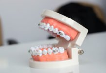 Tips-to-Straighten-Your-Teeth-Faster-With-Ease-on-lightningidea