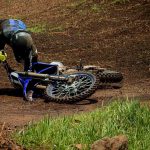 Can Motorcycle Accident Lawyers Help You Navigate Complex Injury Claims on lightningidea